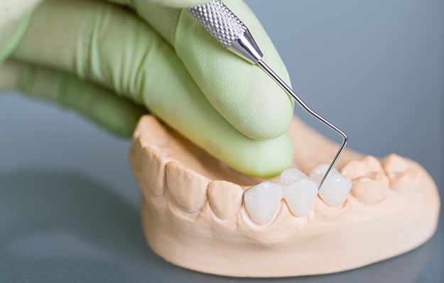 A woman holding a dental bridge