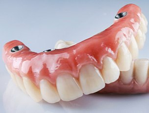 closeup of implant dentures