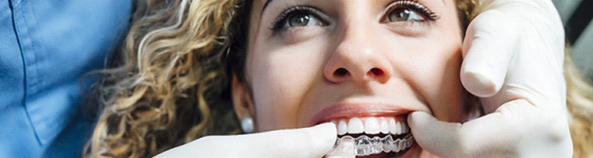 a dentist in Selbyville showing a patient how to put in their ClearCorrect aligners