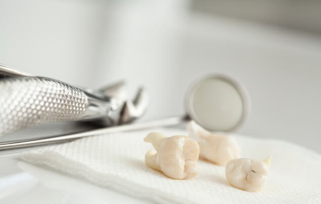 Three extracted teeth on napkin next to dental instruments