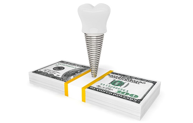 Illustrated dental implant on a pile of money