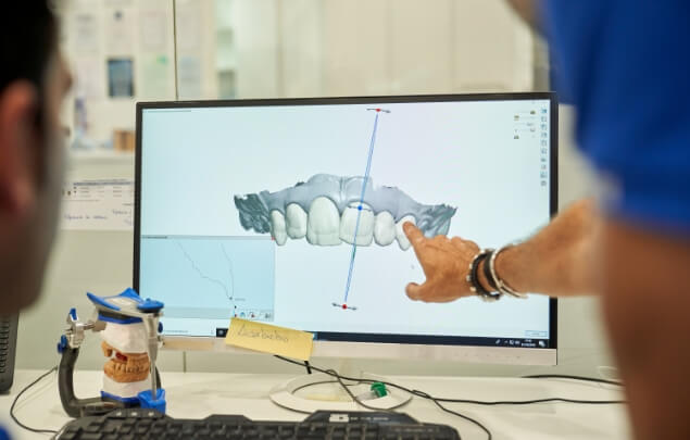 Dentist showing a patient a screen with digital impressions of their teeth