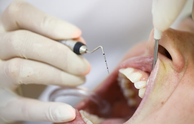 Close up of a dental patient receiving gum disease treatment