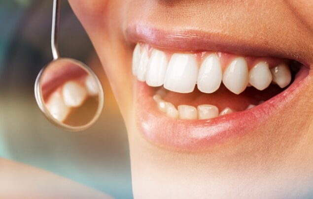 Close up of dental mirror reflecting a smile with white teeth