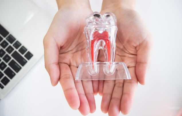 Hands holding a clear model of the tooth showing the nerves inside of it