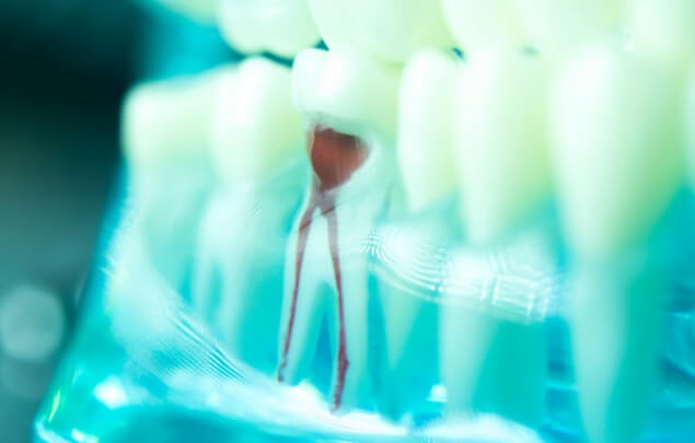 Model of tooth showing root canals inside of it