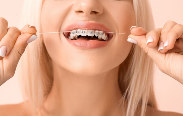 Woman with braces flossing her teeth