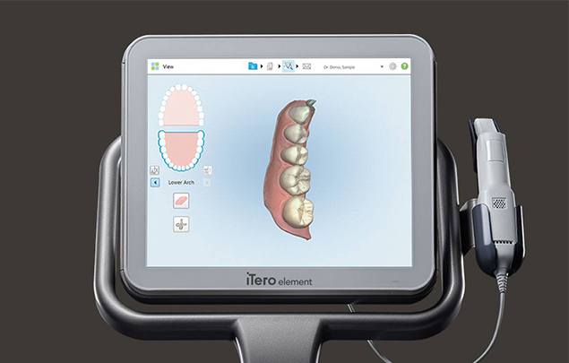 Digital impressions of teeth on chairside computer