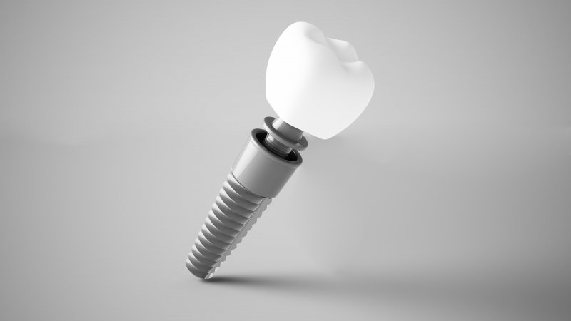 3D rendering of a dental implant