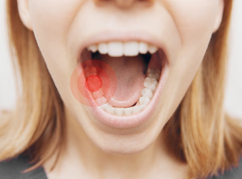 closeup of a woman’s mouth with a red target in between her teeth 